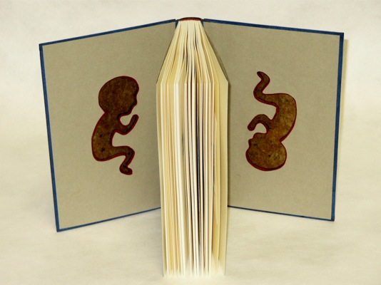 Loading Image